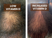 Vitamin D